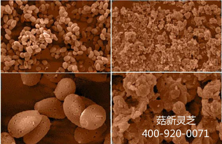 電子顯微鏡下兩款靈孢子粉的對(duì)比圖